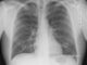diagnosis 1476620 1280