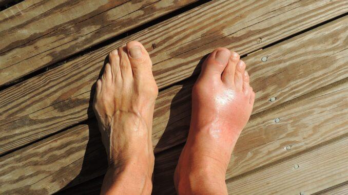 feet 174216 1280