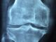knee 1406964 1280