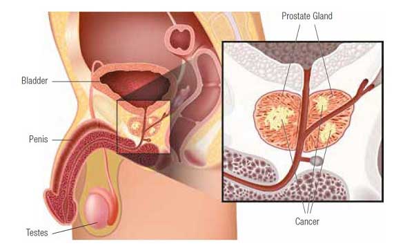 prostate