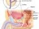 prostate basic lg