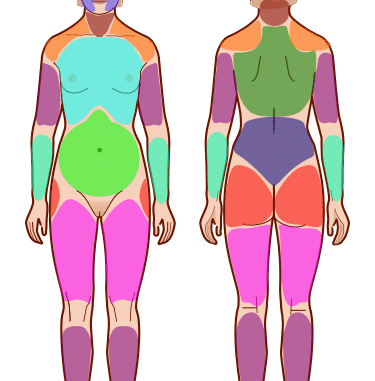 Widespread Pain Index Areas.svg