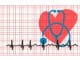 arrhythmia 9559163 1280
