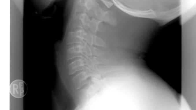 xray 1129436 1280